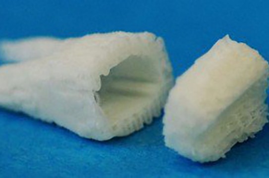 tooth-scaffold-implants
