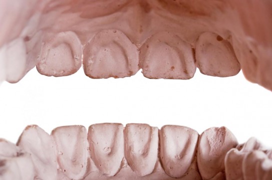 Dental-Teeth-Tooth-Dentures