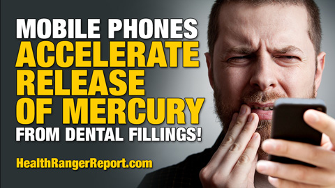 Mobile-Phones-Accelerate-Release-of-Mercury-Dental-Fillings-480
